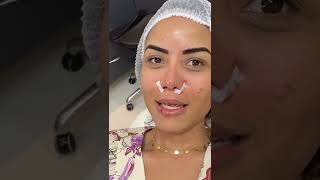 Resultado imediato da rinomodelacao definitiva