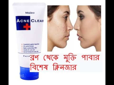Download Mistine Acne Clear Face Wash #MadeInThailand #bestacnesolution #acnesolve #skincare #oilcontrol