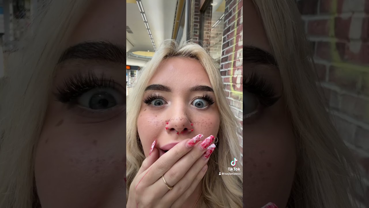 MY FRECKLES- | KAYLAMALECC | 