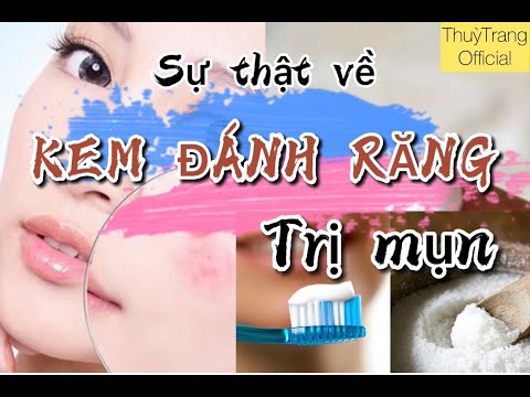 TRỊ MỤN bằng KEM ĐÁNH RĂNG, Đơn Giản Tại Nhà [Chăm Sóc Da Tại Nhà]