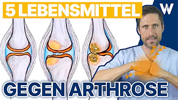 Was isst man am besten bei Arthrose?