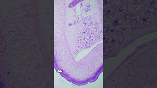 Taenia Pisiformis Section Under The Microscope