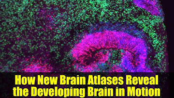 How New Brain Atlases Reveal the Developing Brain in Motion