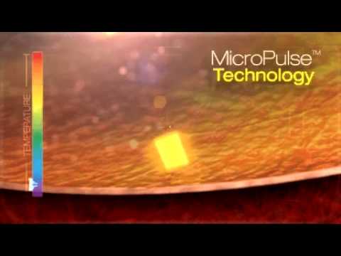 IRIDEX Micropulse Technology for Tissue Sparing
