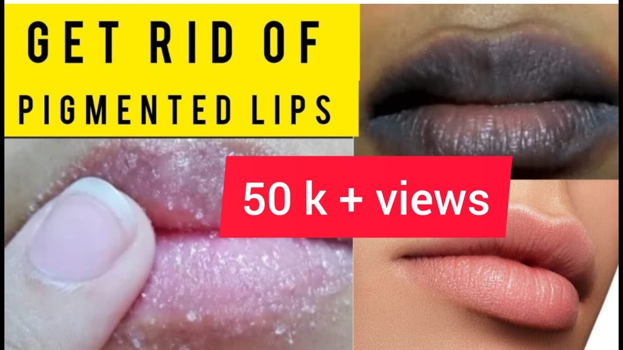Get Rid of Pigmented Lips 💋 How to Get Pink Lips?? lip lightening