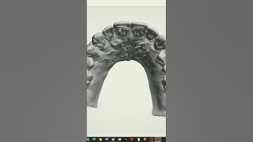 Digital Diagnostic Waxup