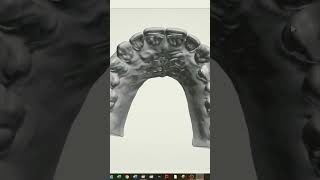 Digital Diagnostic Waxup