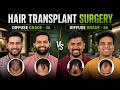 Hair Transplant in Kerala (HX-HUYH) | Best Results & Cost of Hair Transplant in Kerala