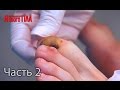 Я стесняюсь своего тела. Сезон 3. Выпуск 16. Часть 2 из 5