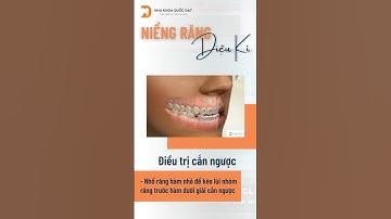 Khớp cắn ngược răng trước, bạn có biết không? #niengrang #niengrangmaccai #nkqd #nhakhoaquocdat