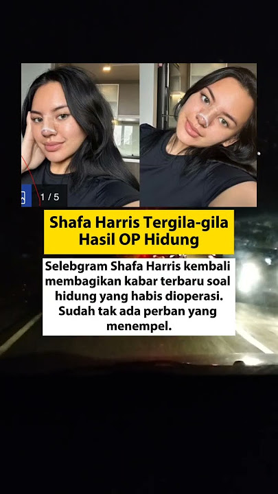 Shafa Harris OP Hidung. #shafaharis #viral #selebgram #shorts