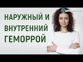 Геморрой: наружный и внутренний. Как отличить?