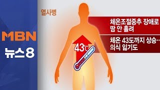 폭염에 땀조차 나지 않는다면 바로 병원으로!