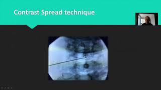 Webinar presentation at British Pain Society ASM 2018