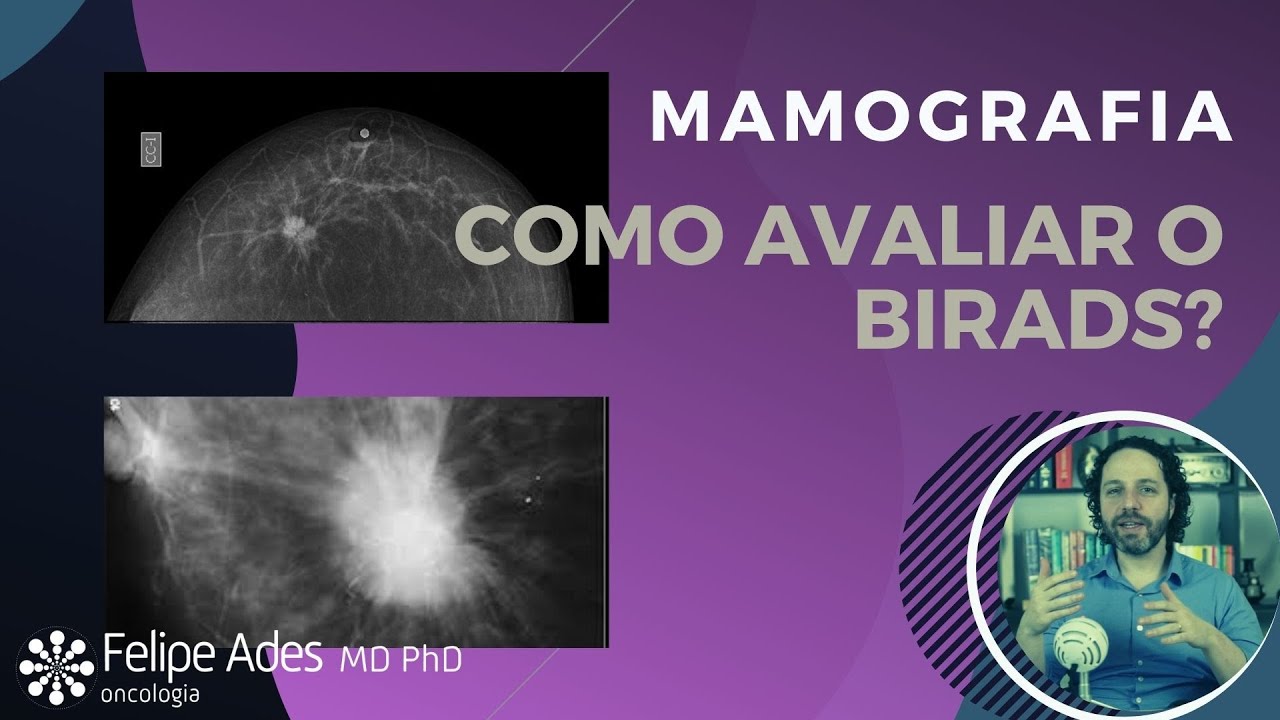 CÂNCER DE MAMA Como se avalia o exame de mamografia? O que é o BIRADS? YouTube CÂNCER DE MAMA Como se avalia o exame de mamografia? O que é o BIRADS? YouTube