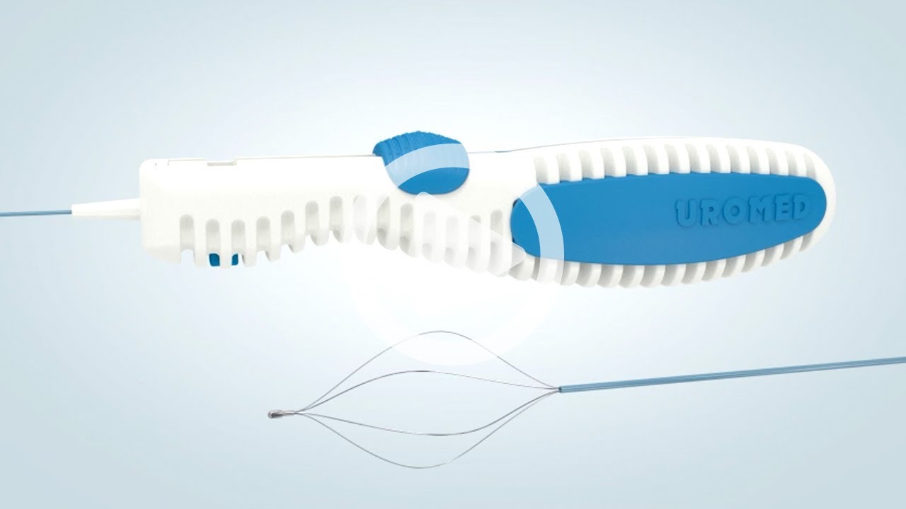 UROMED STONIZER® Stone Retrieval Basket - For the urological removal of stones from the ureter