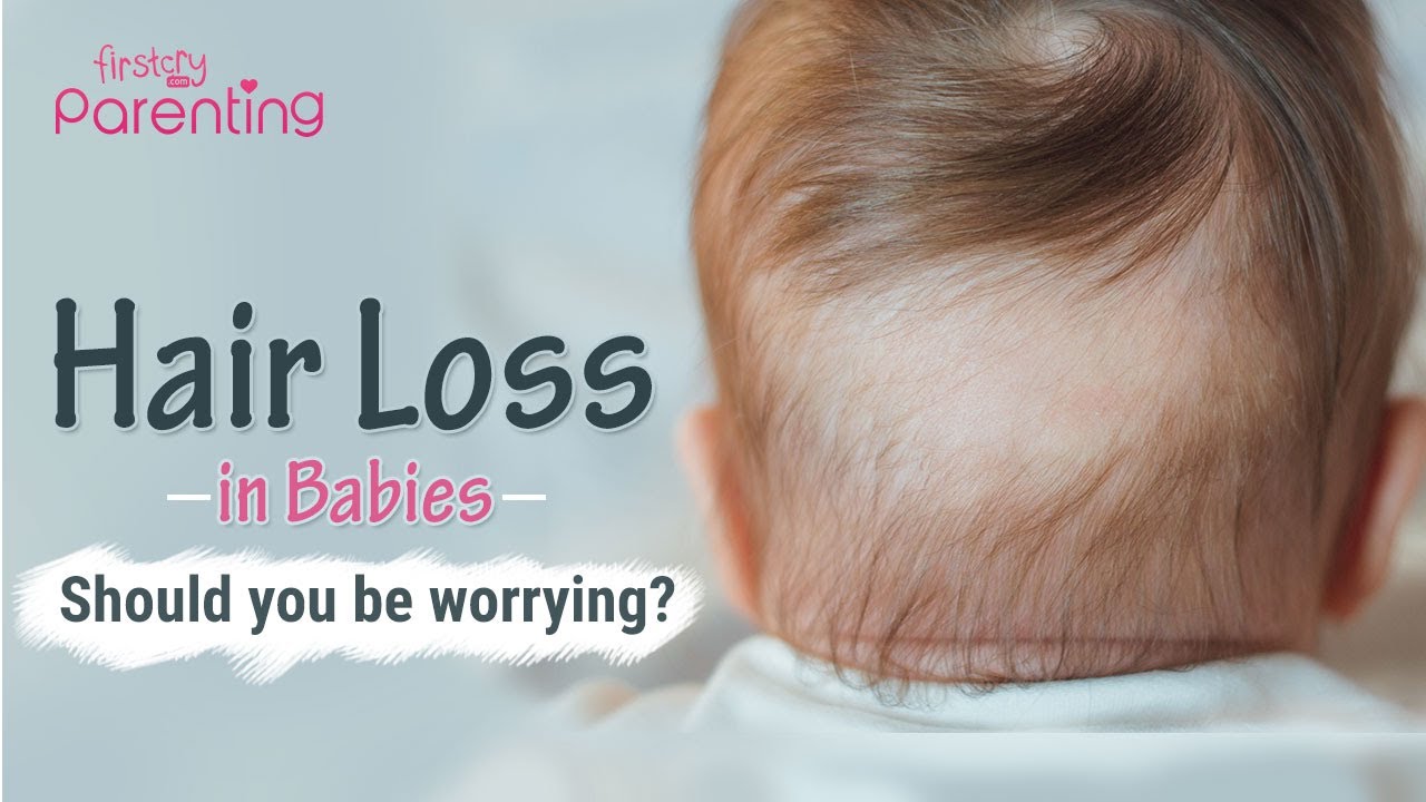 Hair Loss in Babies  Whats Normal and Whats Not  YouTube