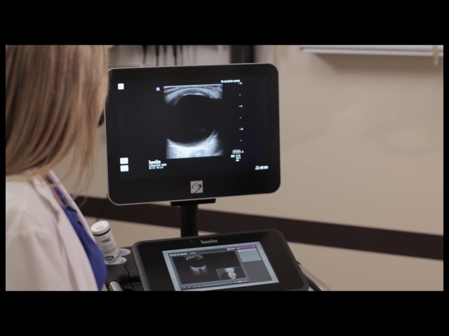 How To: Scan-Along Visual Guides on the Sonosite X-Porte 3D Video class=