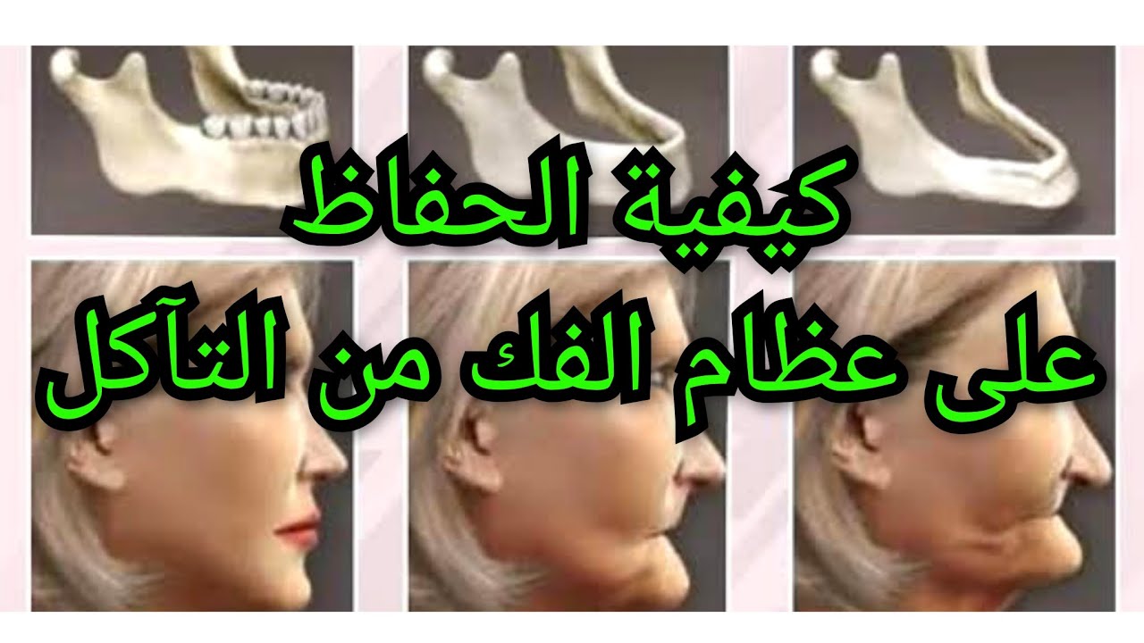 كيفية الحفاظ على عظام الفك من التآكل. حافظ على شكل وجهك و ثبات أسنانك