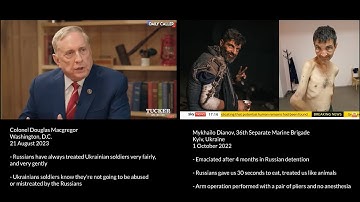 Russia treats Ukrainian soldiers fairly, Douglas Macgregor | Treated like animals, Mykhailo Dianov