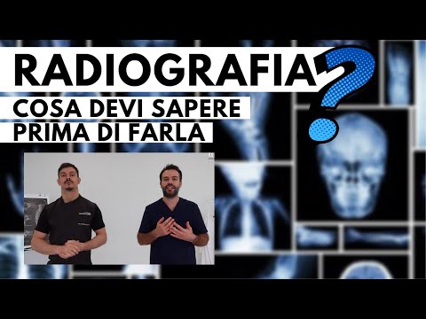 Video: Una spina apparirà su una radiografia?