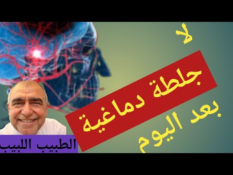 فيديو: كيف تتخلص من السكتة الدماغية الخارجية؟