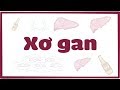 Xơ gan | Osmosis Vietnamese