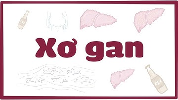 Xơ gan | Osmosis Vietnamese