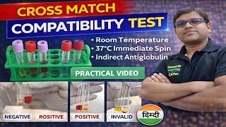 Cross Match practical Video| Compatibility Test | Major and Minor Cross Match