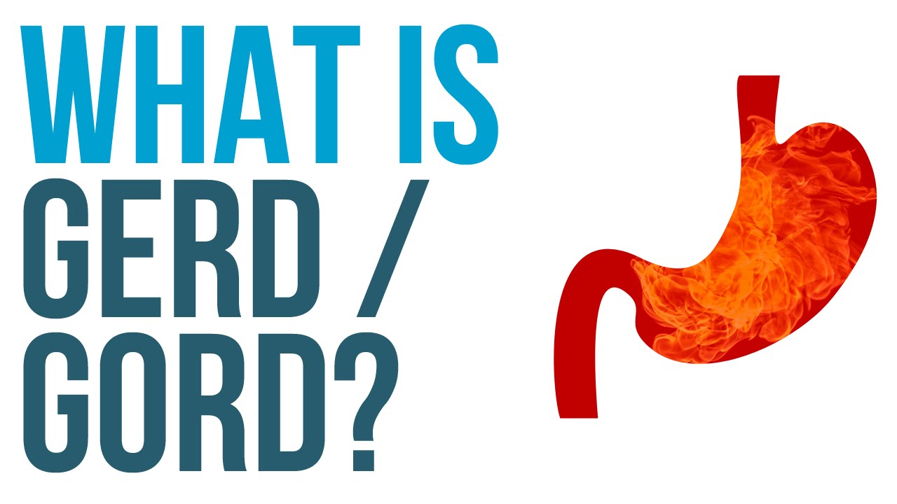 What Is GORD GERD Gastro Oesophageal Reflux Disease YouTube What Is GORD GERD Gastro Oesophageal Reflux Disease YouTube