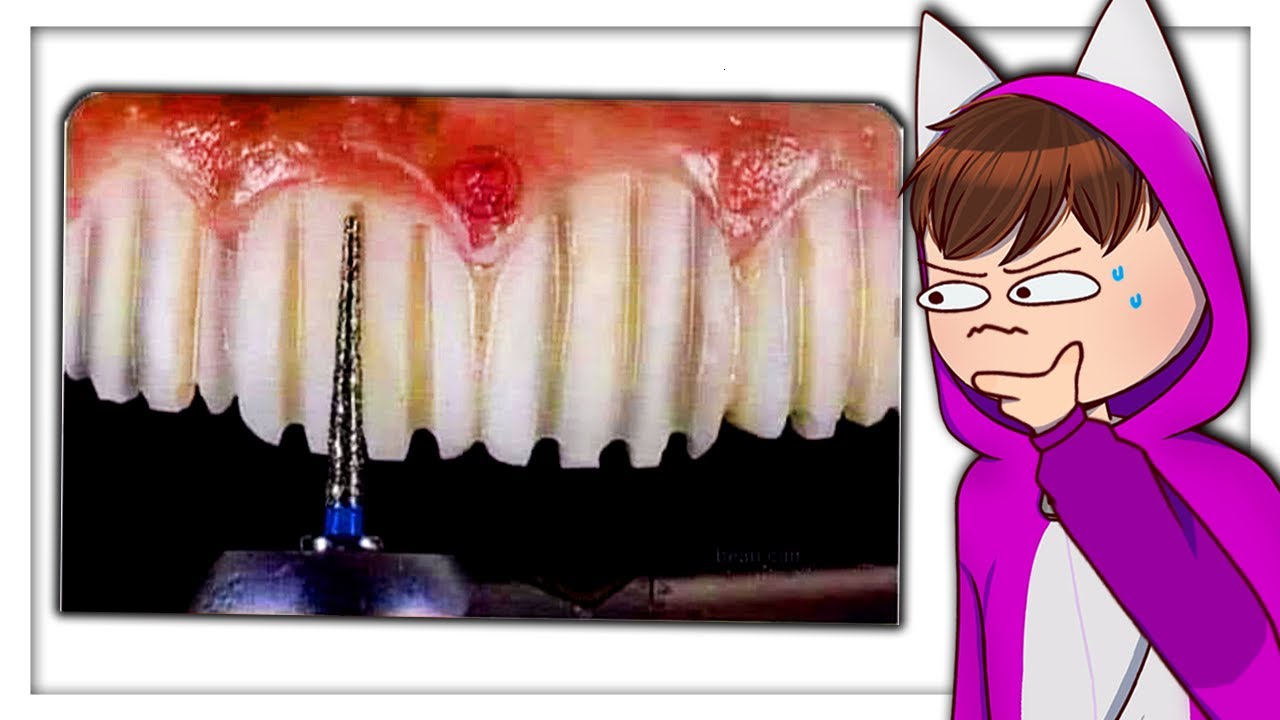 Danke, ich hasse es..