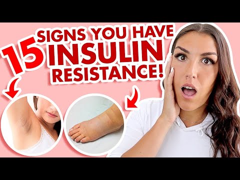 Video: Symptom Resistance
