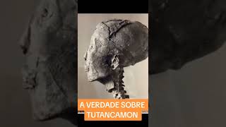 A VERDADEIRA APARENCIA DE TUTANCAMON #trending #foryou #viral