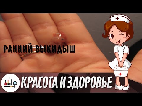 Ранний выкидыш