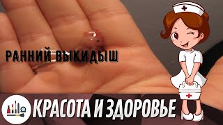 Ранний выкидыш