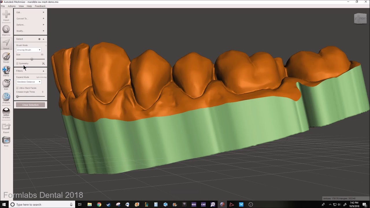 How to prepare and print a diagnostic or retainer model in Formlabs Preform using Meshmixer