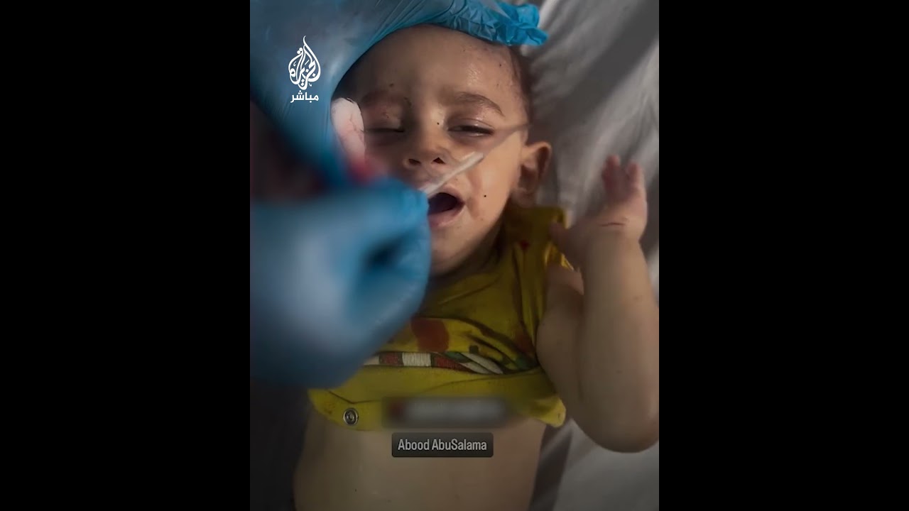 إصابة خطيرة لطفل رضيع جراء قـصـ.ـف إسرائيلي على شمال غزة