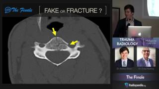 Trauma Radiology Course - Trailer