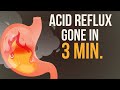 Reduce your Acid Reflux / Heartburn in just 3 Minutes! 🔥