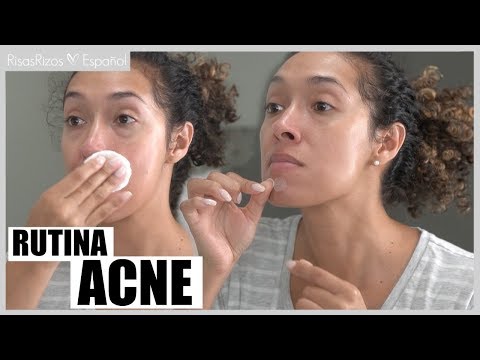 rutina-completa-para-eliminar-el-acnÉ---acne-adulto-hormonal