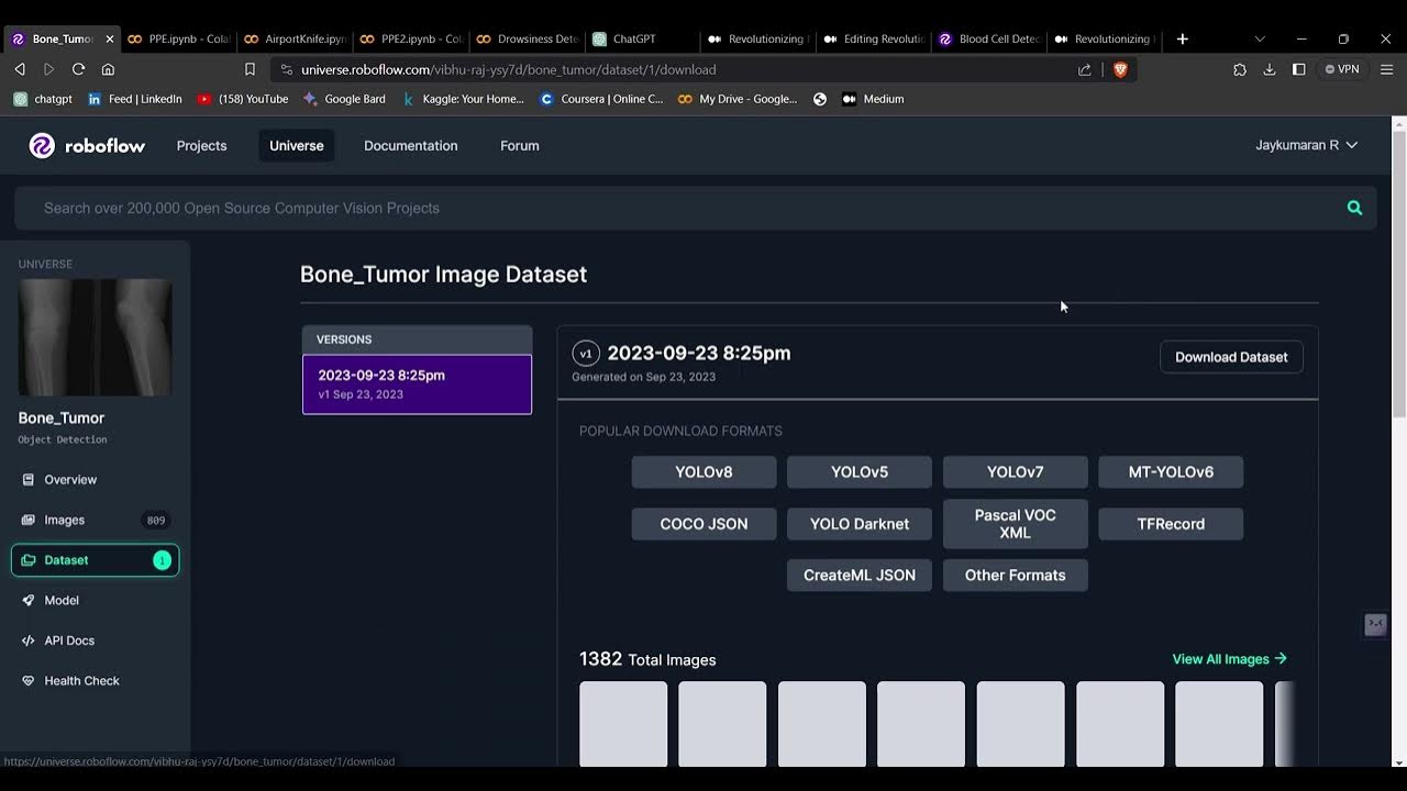 Roboflow dataset how to use for yolo yolov8 tutorial google colab