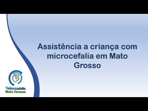 Vídeo: Microcefalia: Pessoas-Ratos. - Visão Alternativa