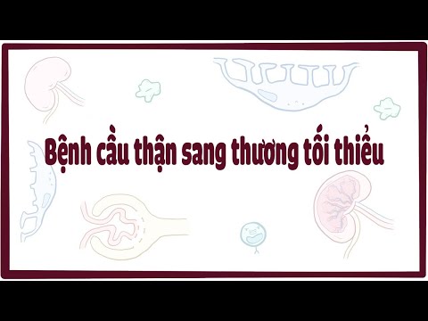 Video: 3 cách để điều trị bệnh thay đổi tối thiểu