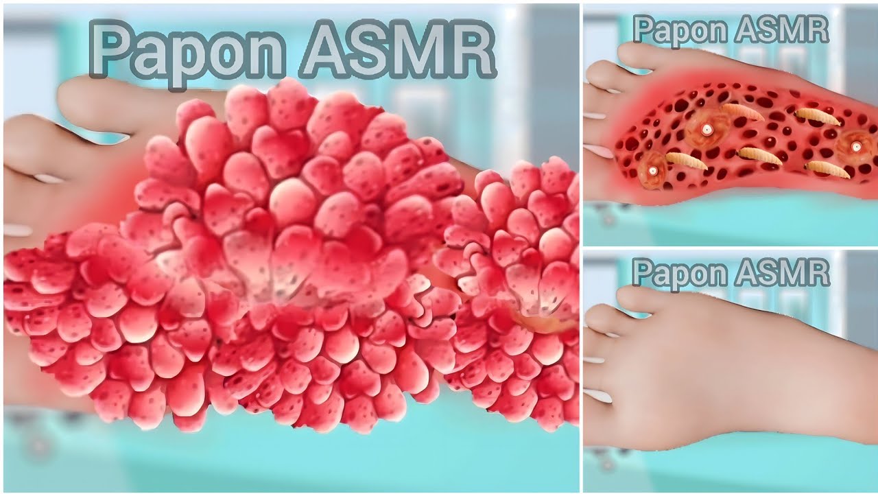 ASMR Treatment Remove Dog s Leg Foot Injected 2d Animation Video asmr-treatment-remove-dog-s-leg-foot-injected-2d-animation-video
