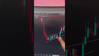 Risk Management Trading | Why It Is Important in Stock Market #trading #riskmanagement