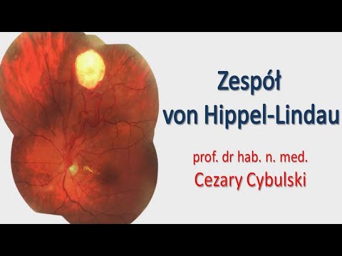 Zespół von Hippel - Lindau - prof. dr hab. n. med. Cezary Cybulski