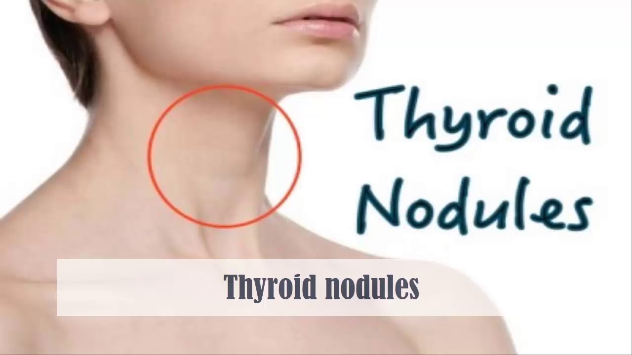 Image result for Know the Symptoms and Risk Factors of thyroid