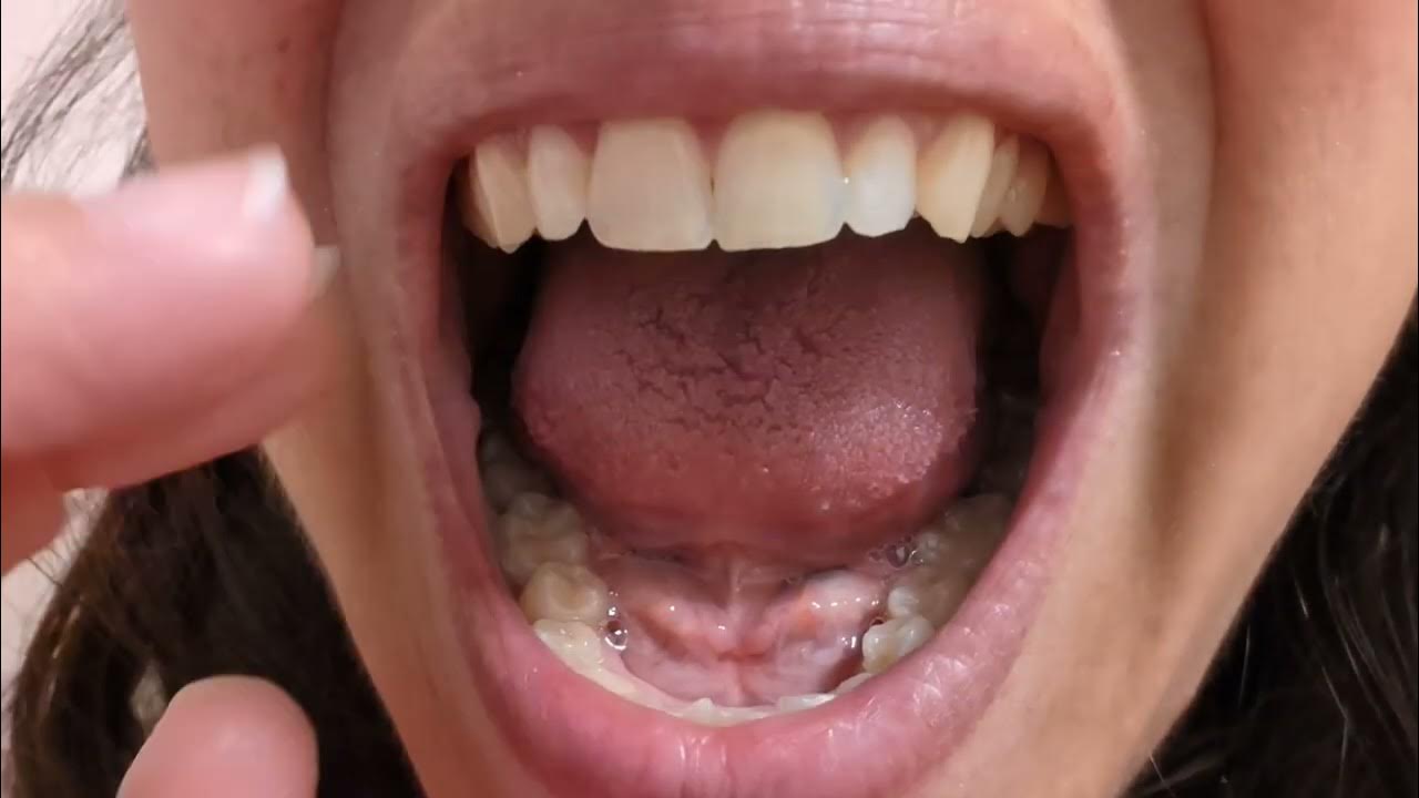 Just Teeth Tapping and Scraping 😁 Mouth Sounds Close Up YouTube