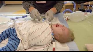 Care of the Medically Complex Child with Tracheostomy and Gastrostomy Tube: tracheostomy tube change