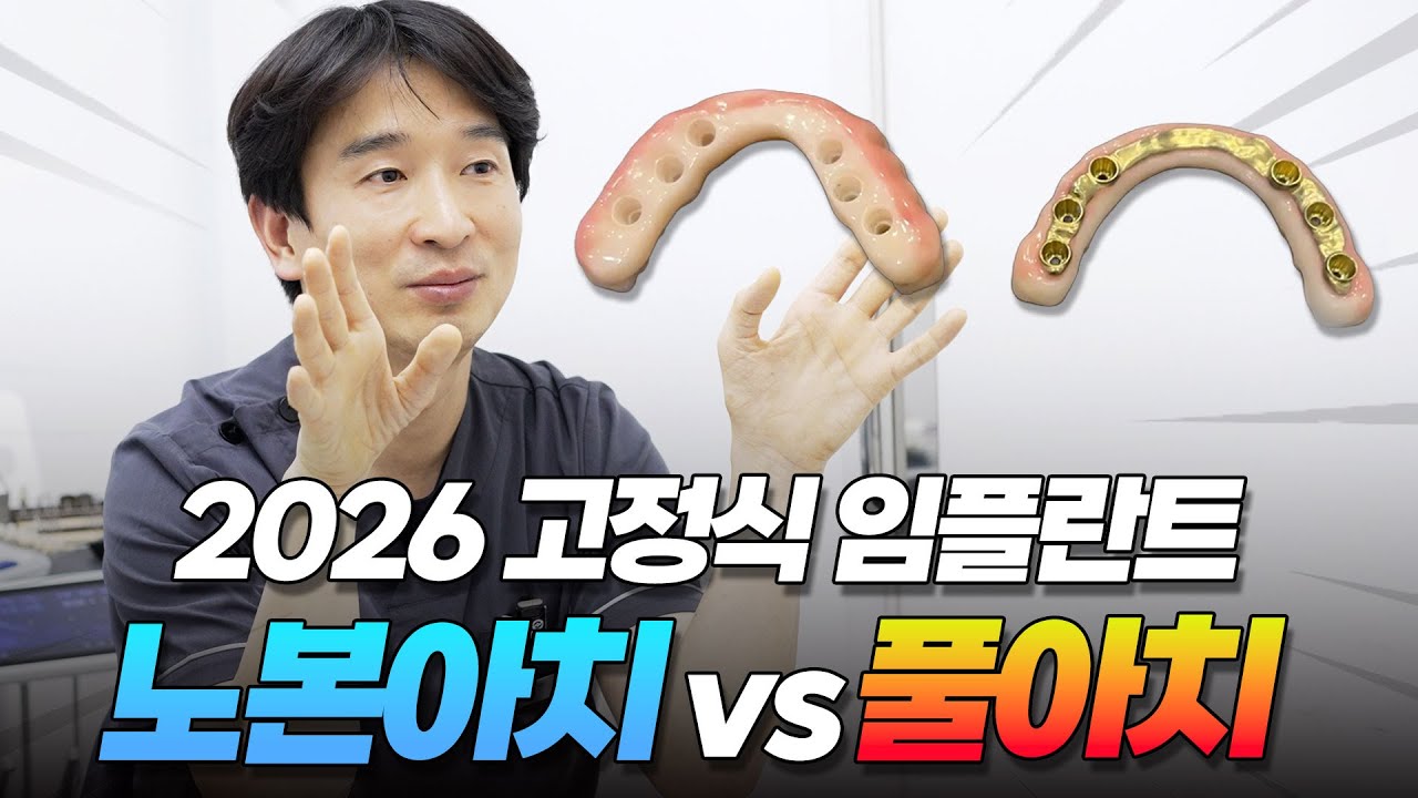 고정식 임플란트의 모든 것! 노본아치 vs 풀아치